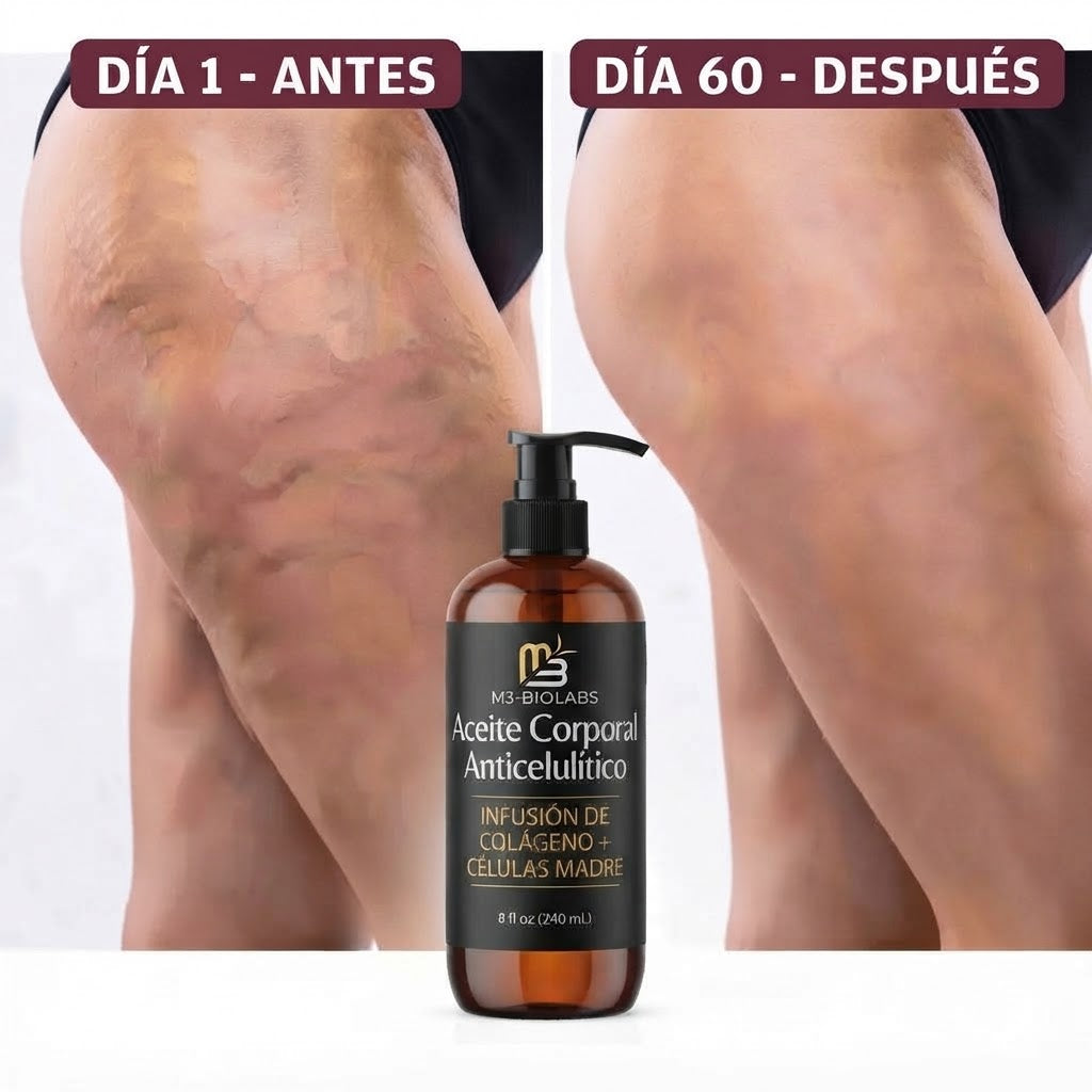 M3 BIOLABS - Aceite Corporal de Triple Acción | Celulitis · Estrías · Flacidez