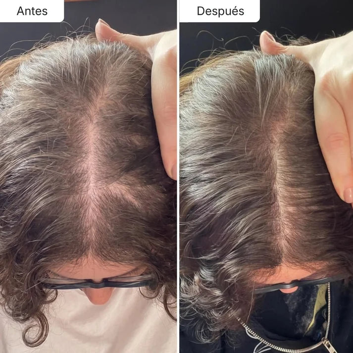 Sérum Anticaída de Doble Acción Para Mujeres| Hair Biolabs™