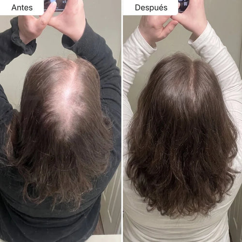 Sérum Anticaída de Doble Acción Para Mujeres| Hair Biolabs™