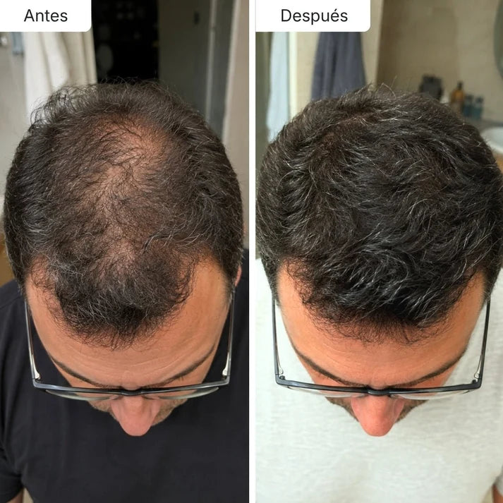 Sérum Anticaída de Doble Acción | Hair Biolabs™