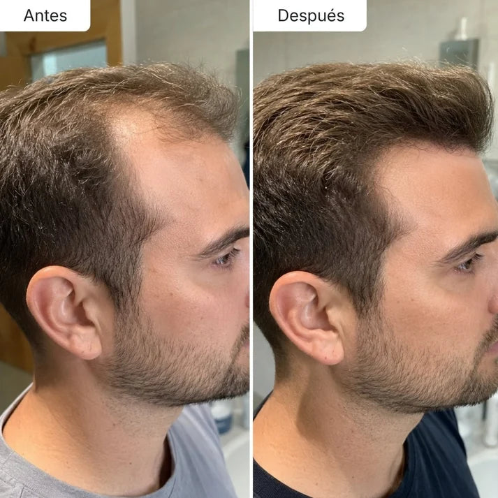 Sérum Anticaída de Doble Acción | Hair Biolabs™